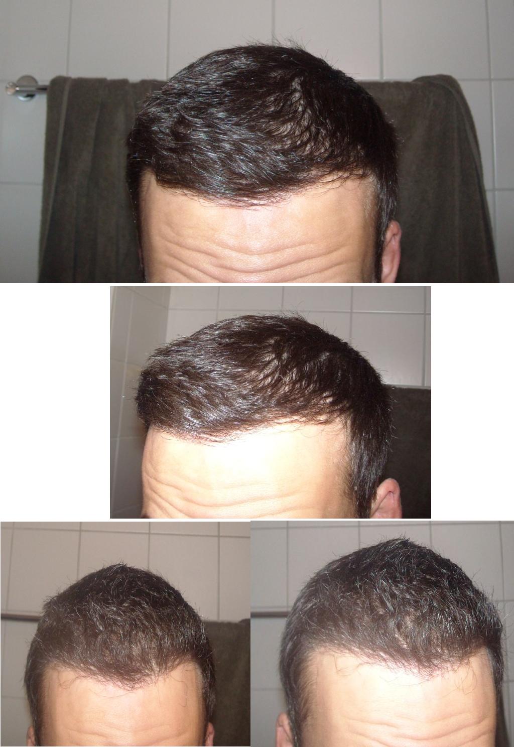 index.php/fa/4207/0/