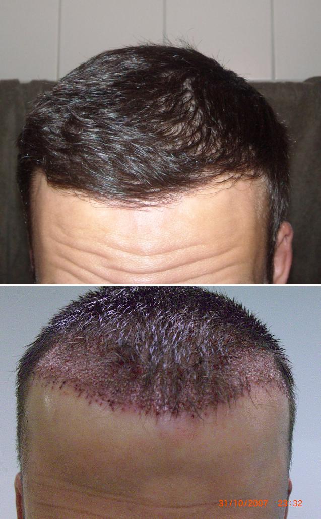 index.php/fa/4208/0/