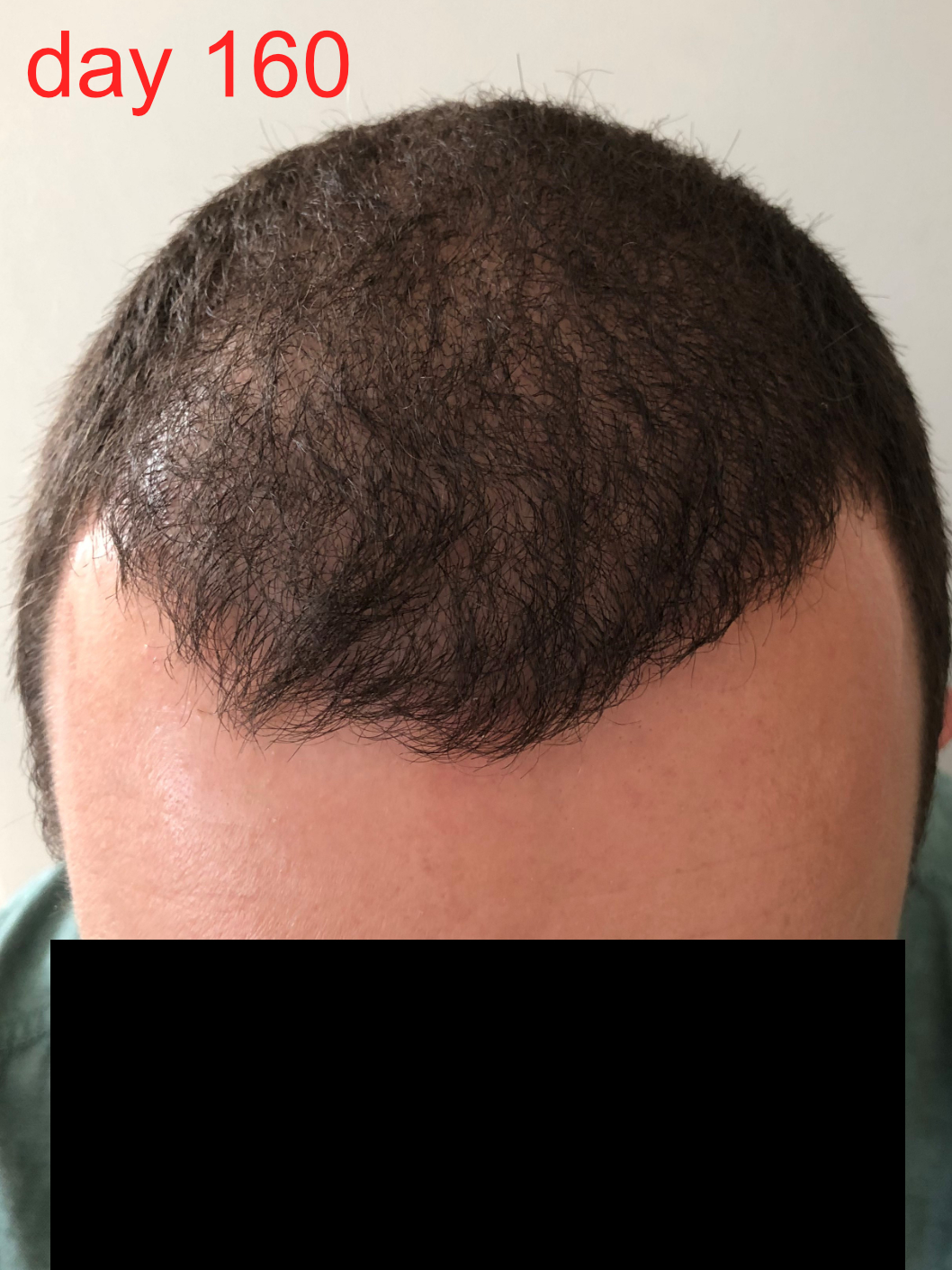 /foren/transplant/index.php/fa/42189/0/