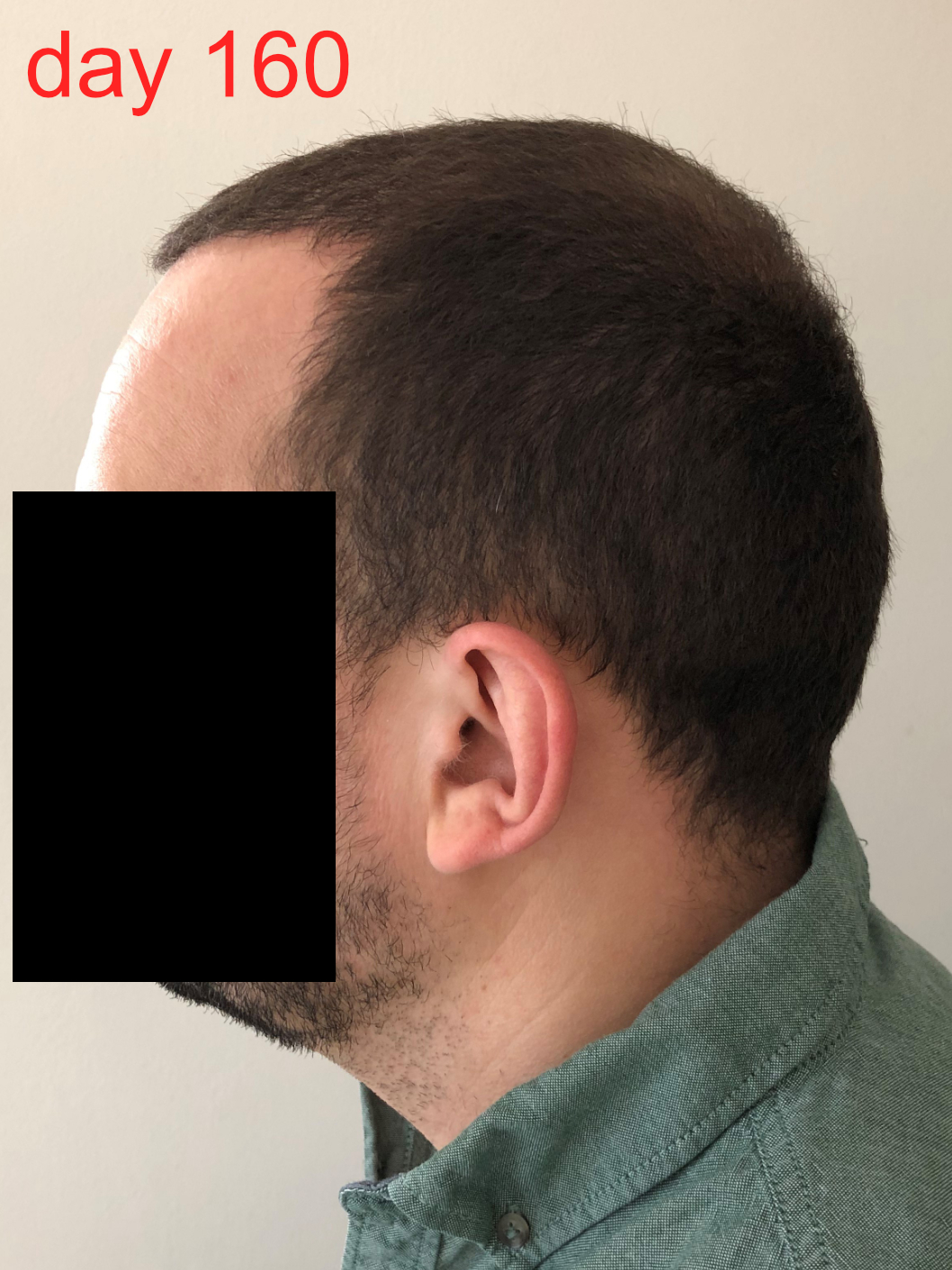 /foren/transplant/index.php/fa/42190/0/