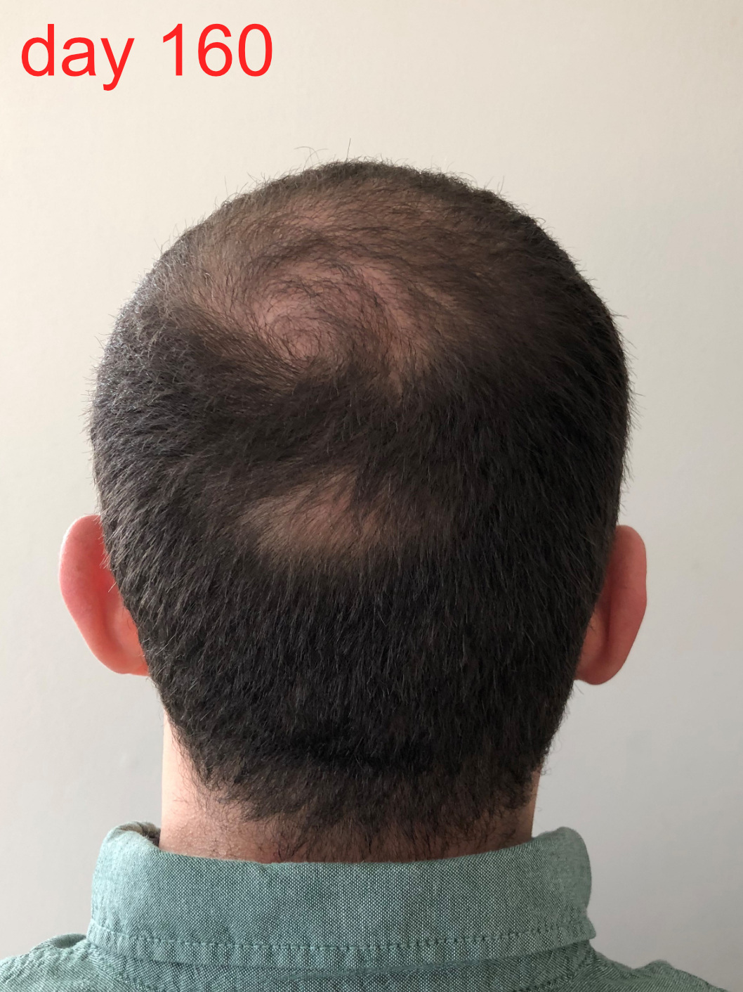 /foren/transplant/index.php/fa/42191/0/