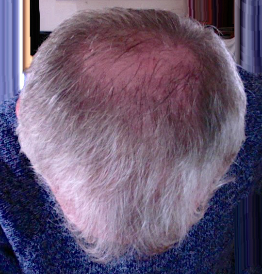 /foren/transplant/index.php/fa/42207/0/