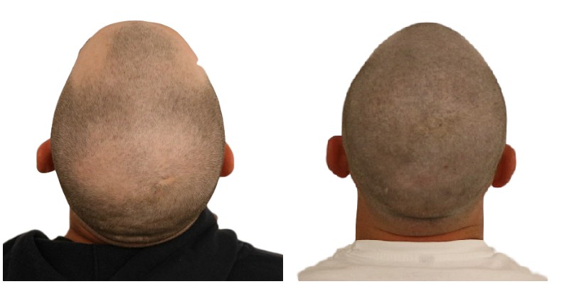 /foren/transplant/index.php/fa/42267/0/