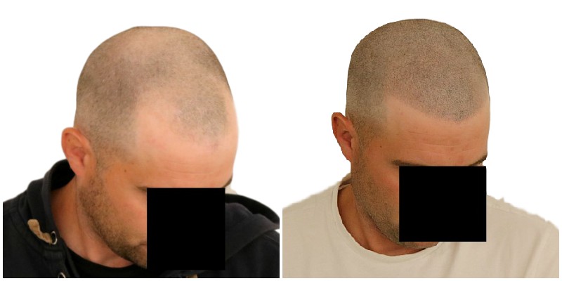 /foren/transplant/index.php/fa/42268/0/