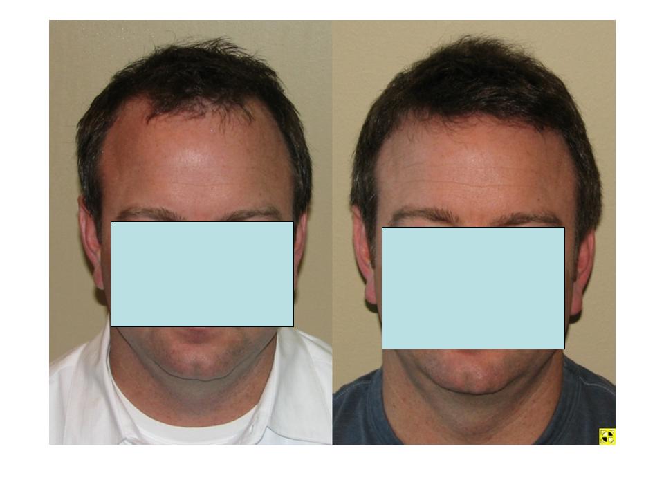 index.php/fa/4245/0/