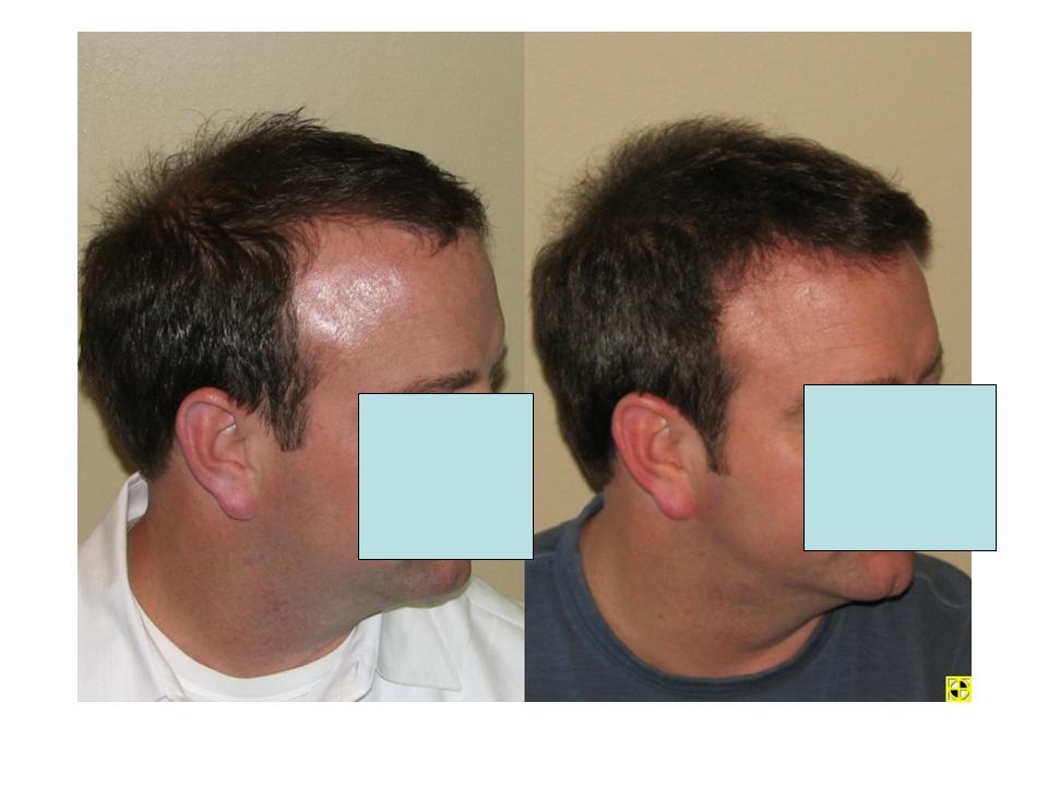 index.php/fa/4247/0/