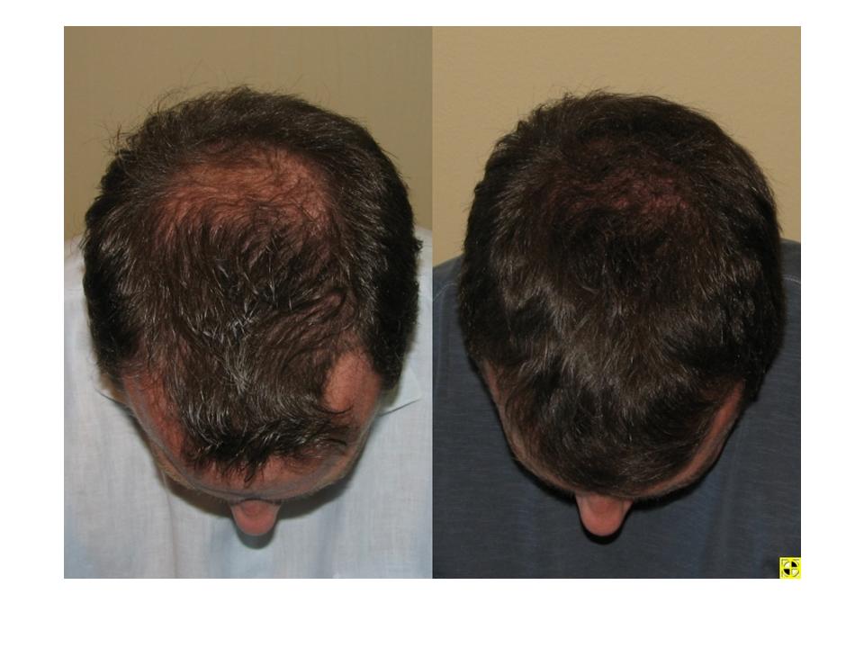 index.php/fa/4249/0/