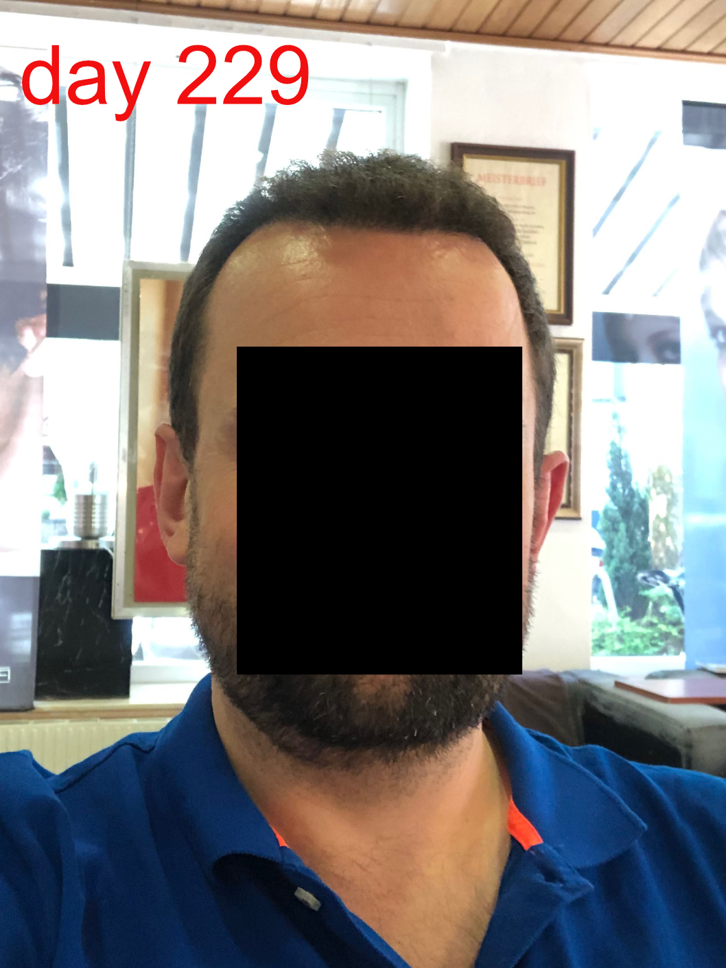 /foren/transplant/index.php/fa/42860/0/