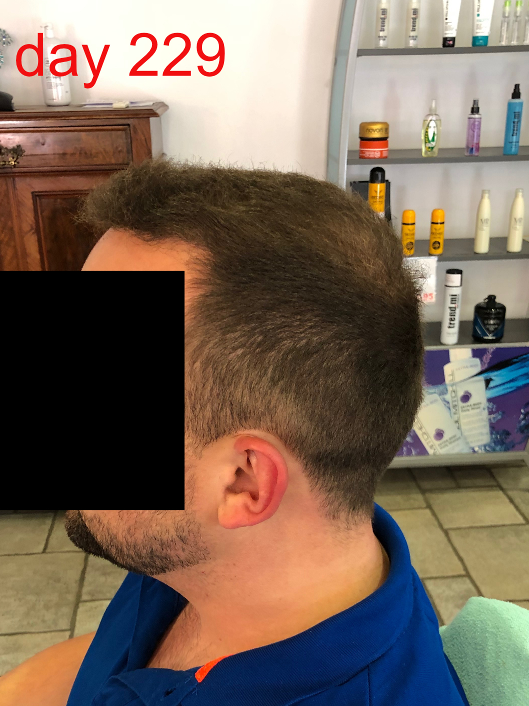 /foren/transplant/index.php/fa/42861/0/