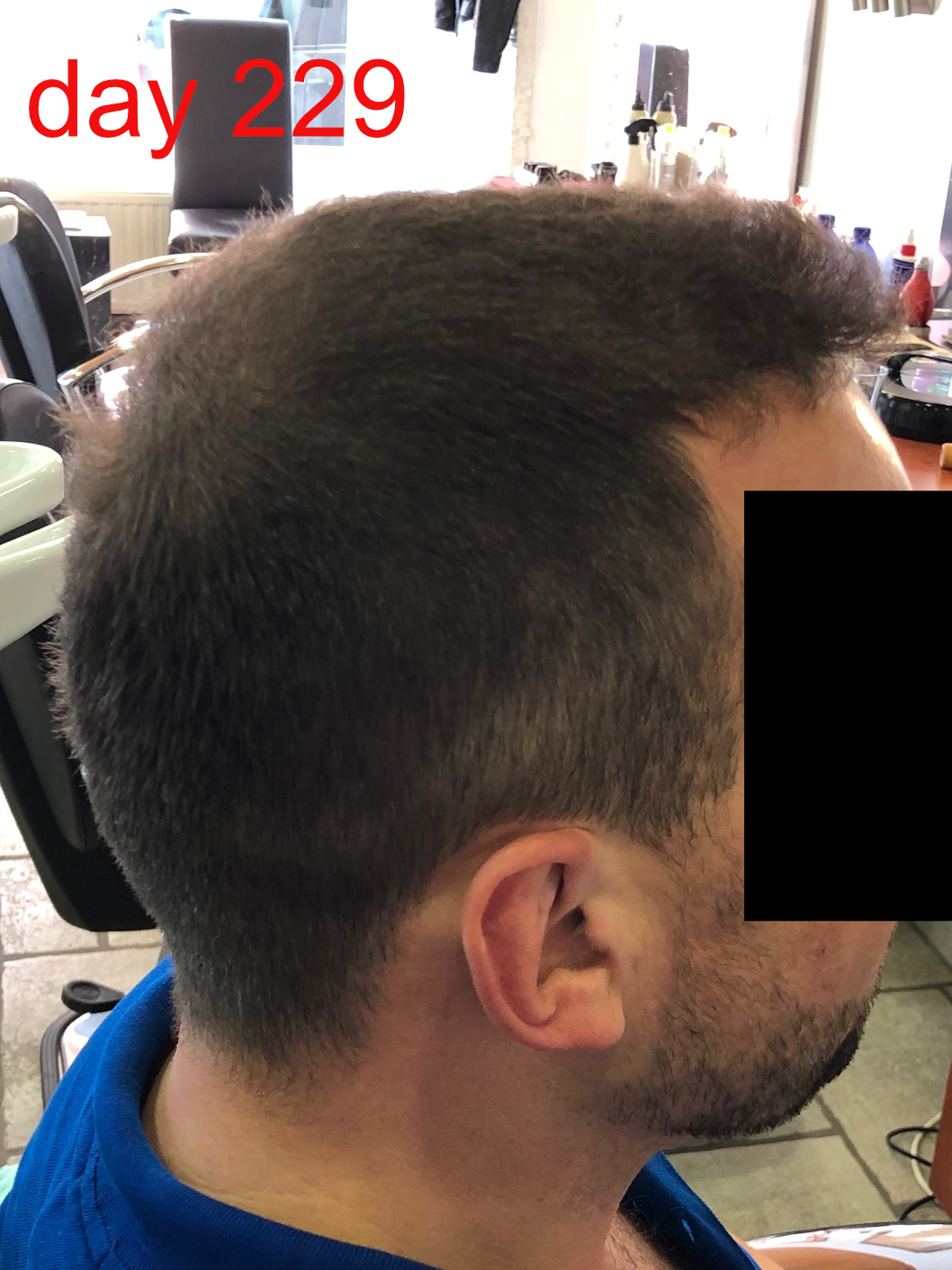 /foren/transplant/index.php/fa/42862/0/