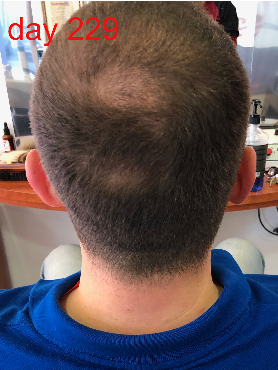 /foren/transplant/index.php/fa/42863/0/