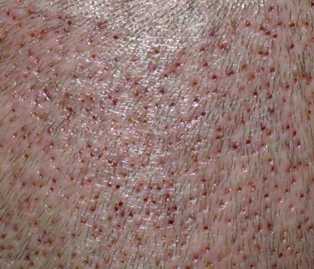 index.php/fa/4290/0/