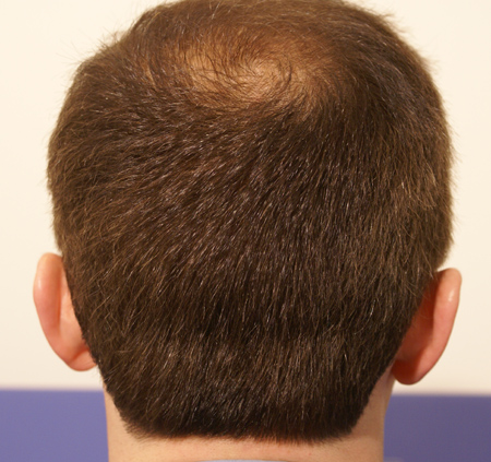 index.php/fa/4304/0/