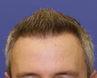 index.php/fa/4305/0/