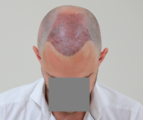 /foren/transplant/index.php/fa/43189/0/