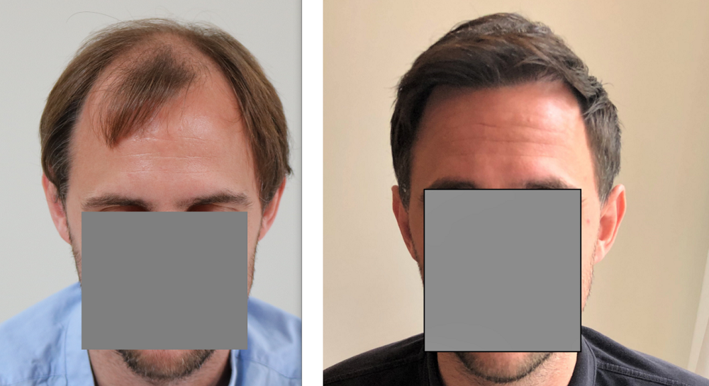 /foren/transplant/index.php/fa/43191/0/