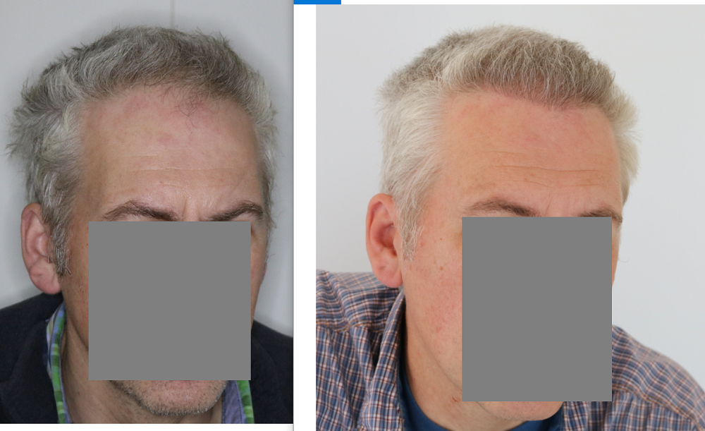 /foren/transplant/index.php/fa/43193/0/