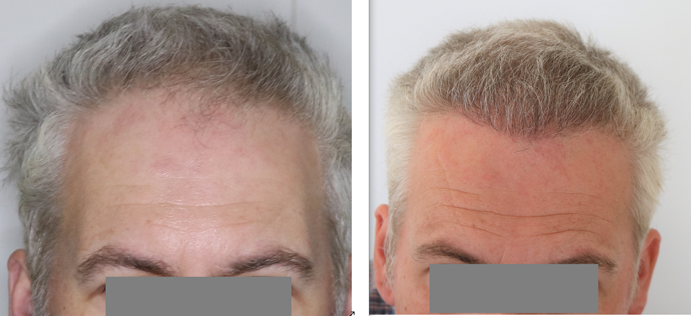 /foren/transplant/index.php/fa/43195/0/