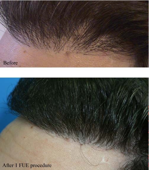 index.php/fa/4323/0/