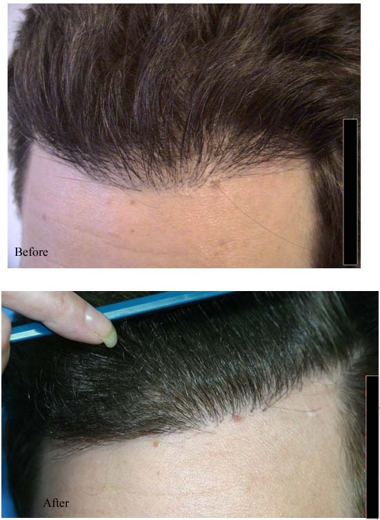 index.php/fa/4324/0/