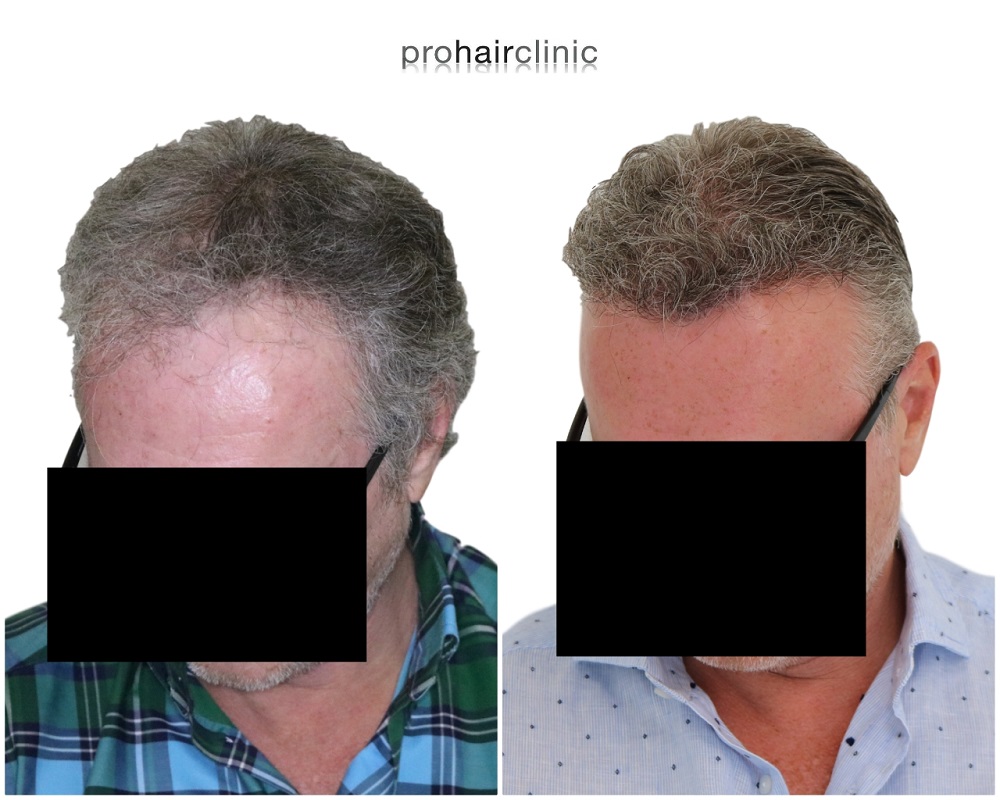 /foren/transplant/index.php/fa/43254/0/