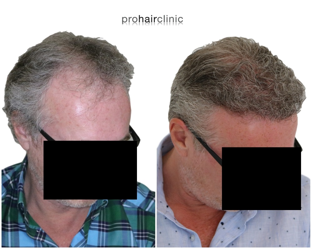 /foren/transplant/index.php/fa/43255/0/