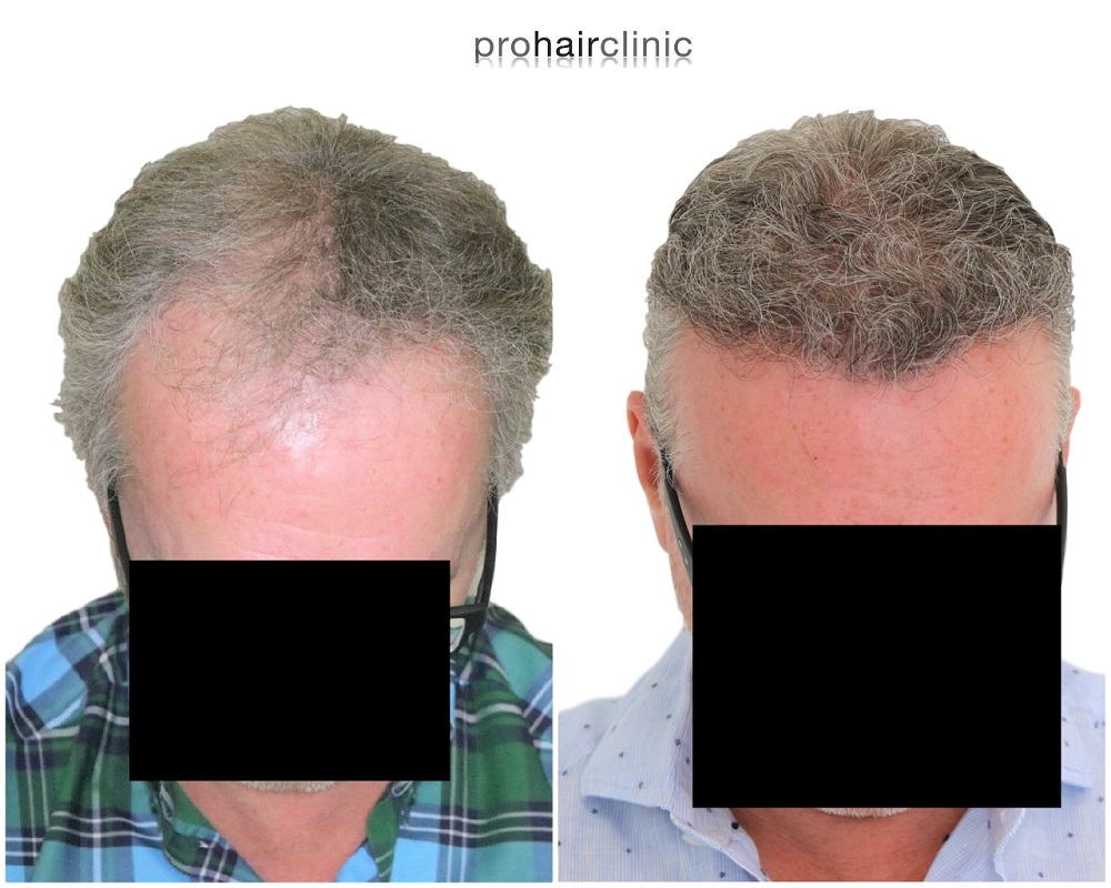 /foren/transplant/index.php/fa/43256/0/