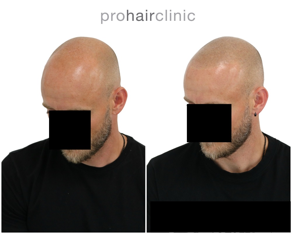 /foren/transplant/index.php/fa/43269/0/