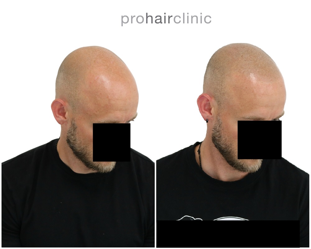 /foren/transplant/index.php/fa/43270/0/