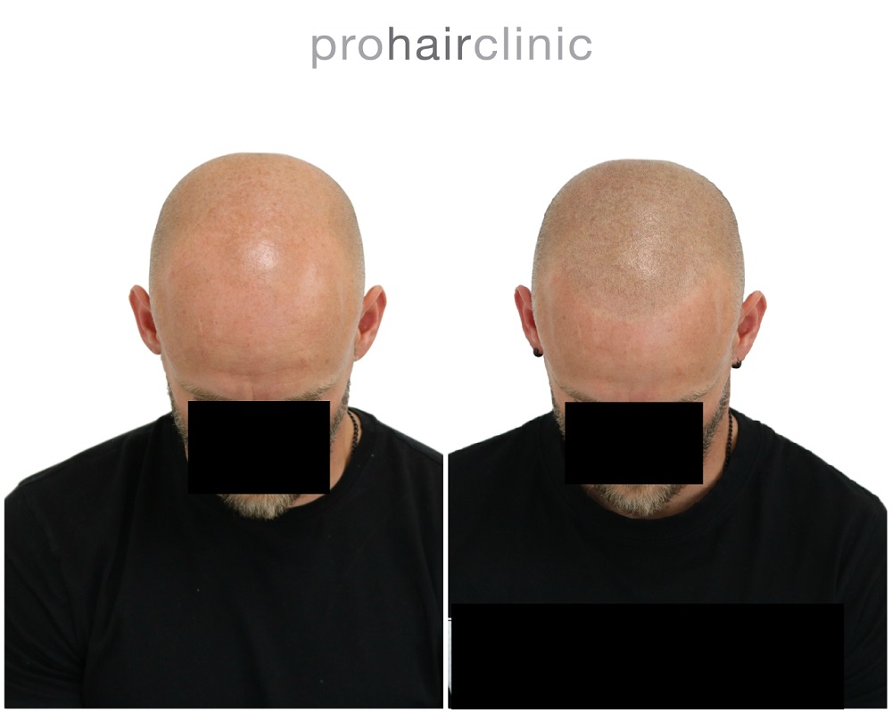 /foren/transplant/index.php/fa/43271/0/