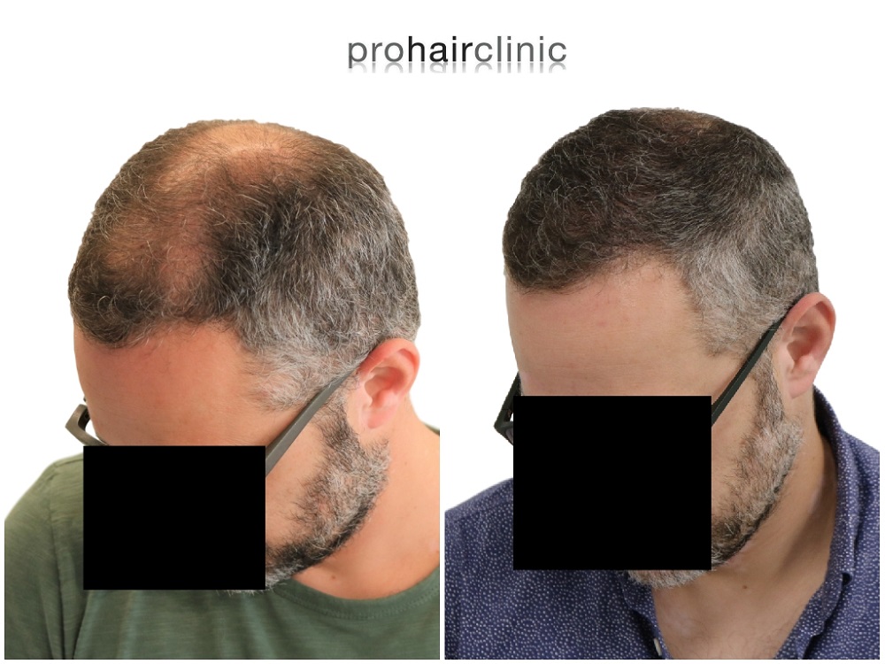 /foren/transplant/index.php/fa/43306/0/