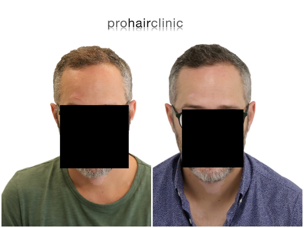 /foren/transplant/index.php/fa/43308/0/