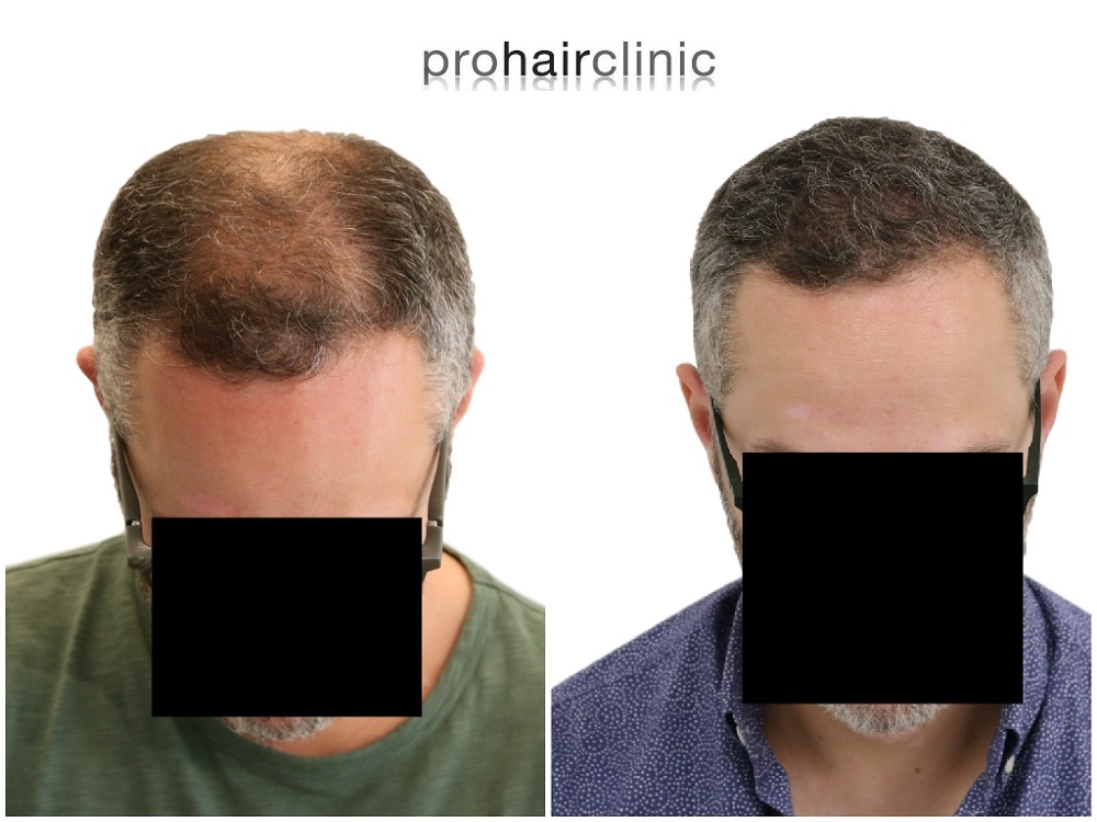 /foren/transplant/index.php/fa/43309/0/