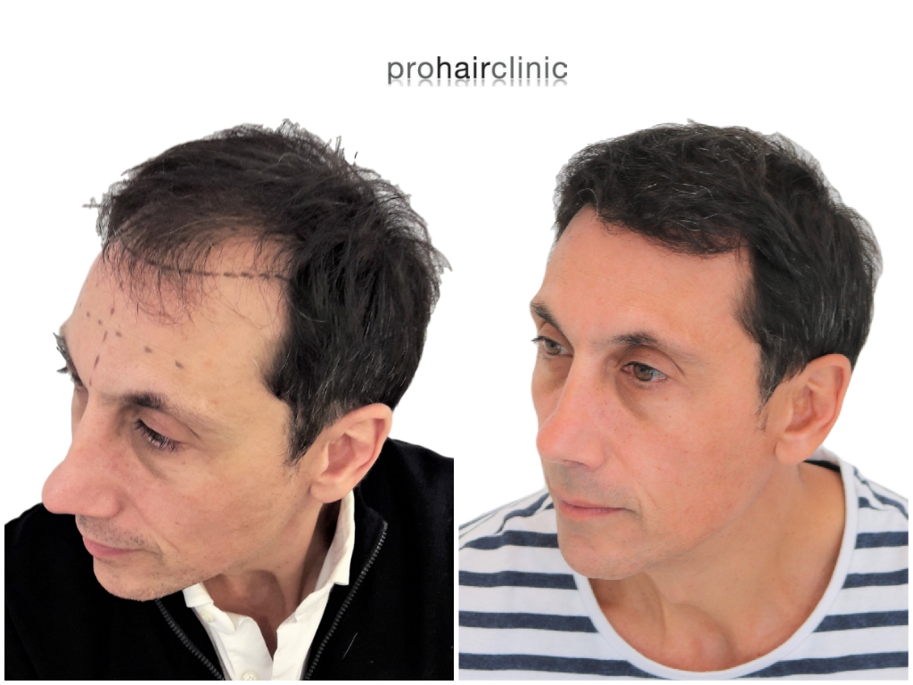 /foren/transplant/index.php/fa/43345/0/