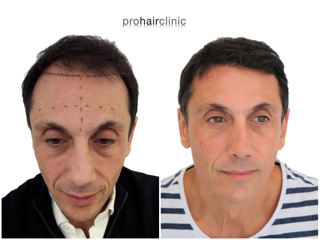 /foren/transplant/index.php/fa/43348/0/