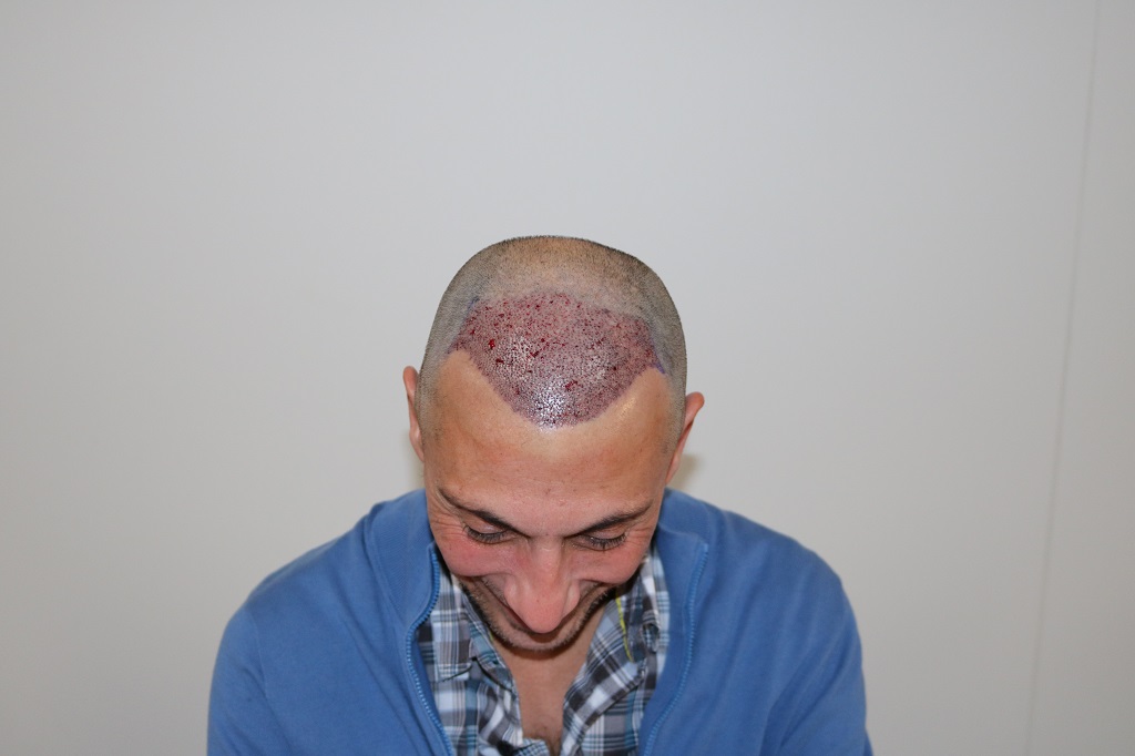 /foren/transplant/index.php/fa/43349/0/