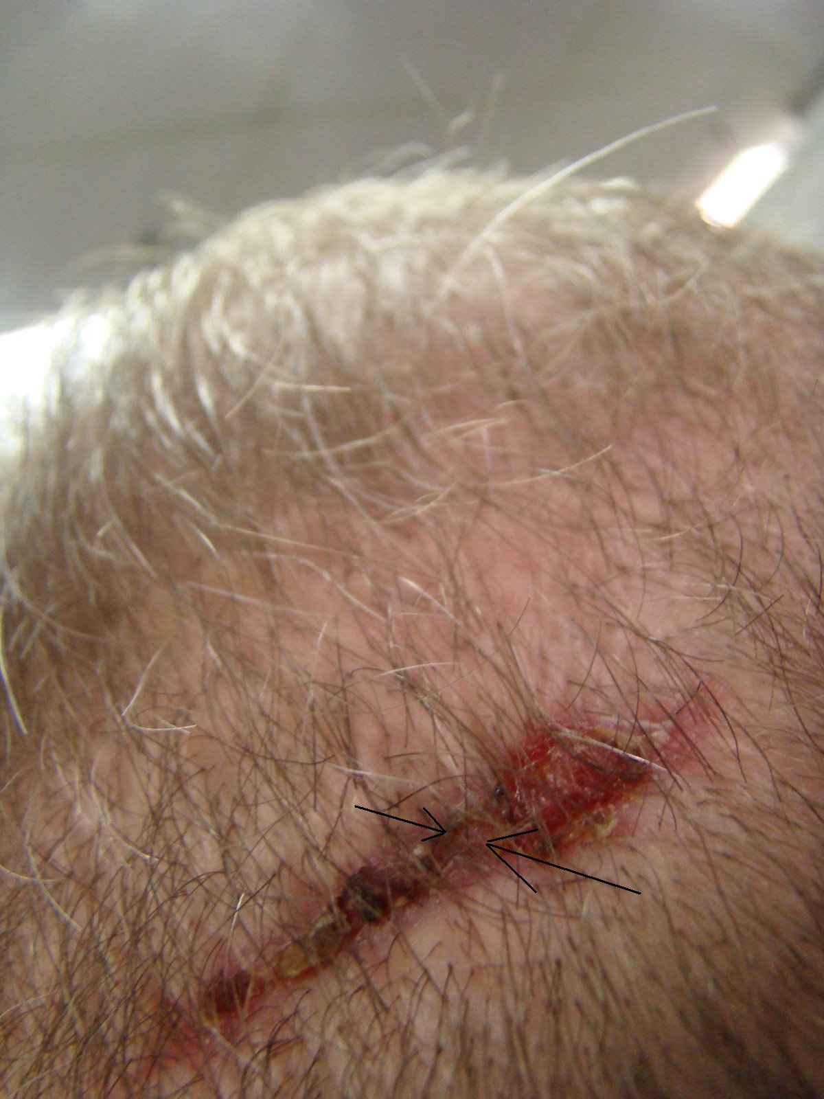 index.php/fa/4337/0/