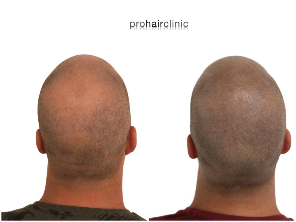 /foren/transplant/index.php/fa/43373/0/