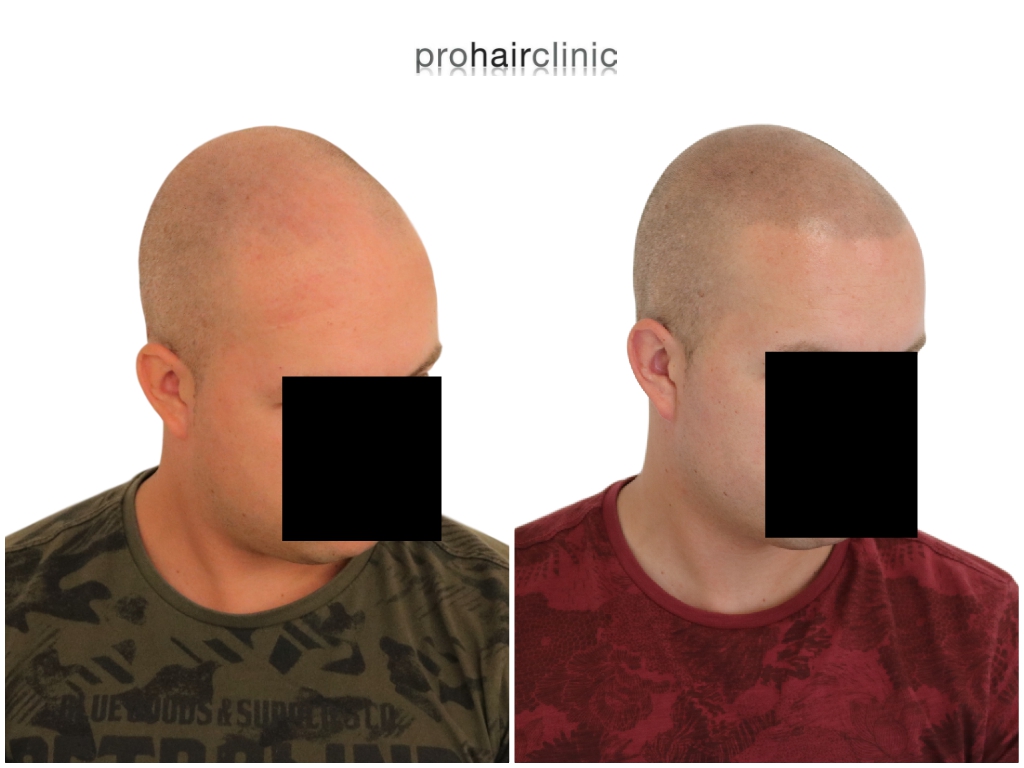 /foren/transplant/index.php/fa/43375/0/