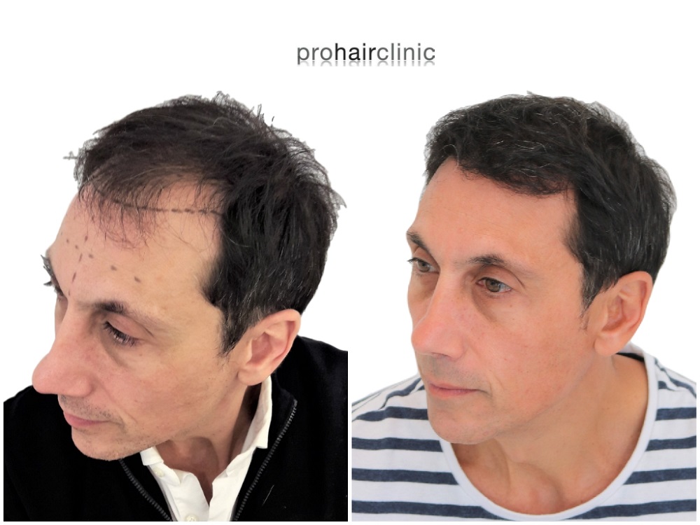 /foren/transplant/index.php/fa/43407/0/