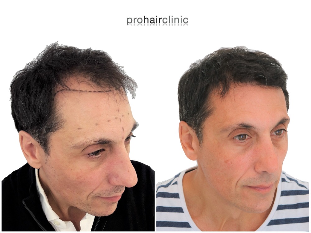 /foren/transplant/index.php/fa/43408/0/