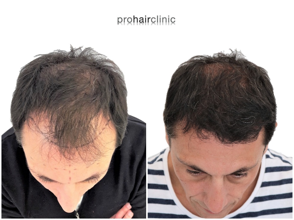 /foren/transplant/index.php/fa/43409/0/