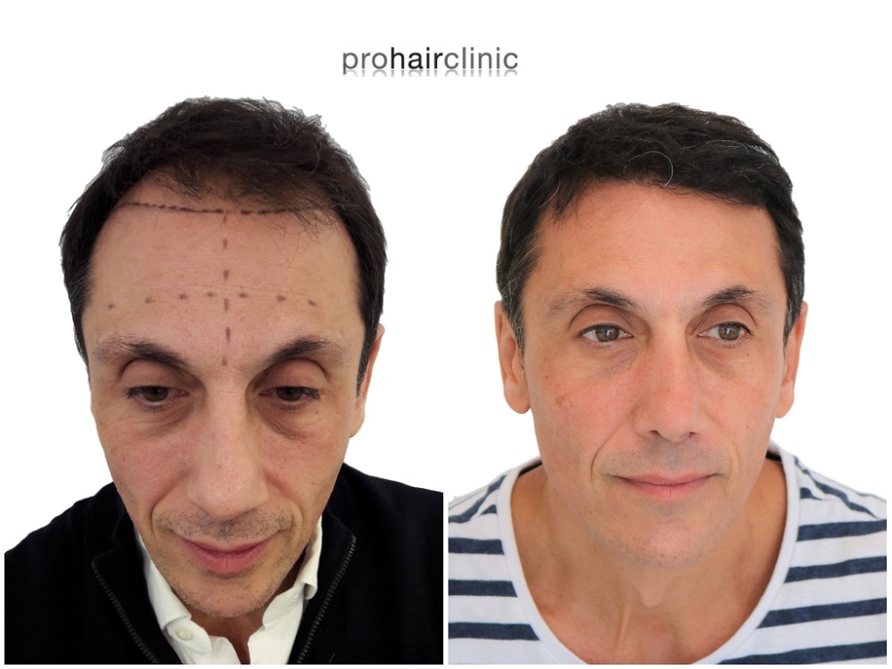 /foren/transplant/index.php/fa/43410/0/