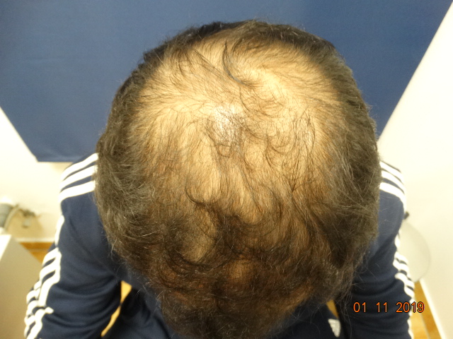 /foren/transplant/index.php/fa/43526/0/