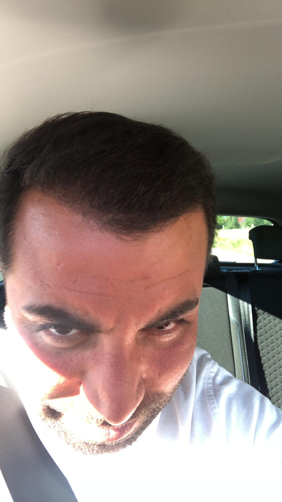 /foren/transplant/index.php/fa/43527/0/