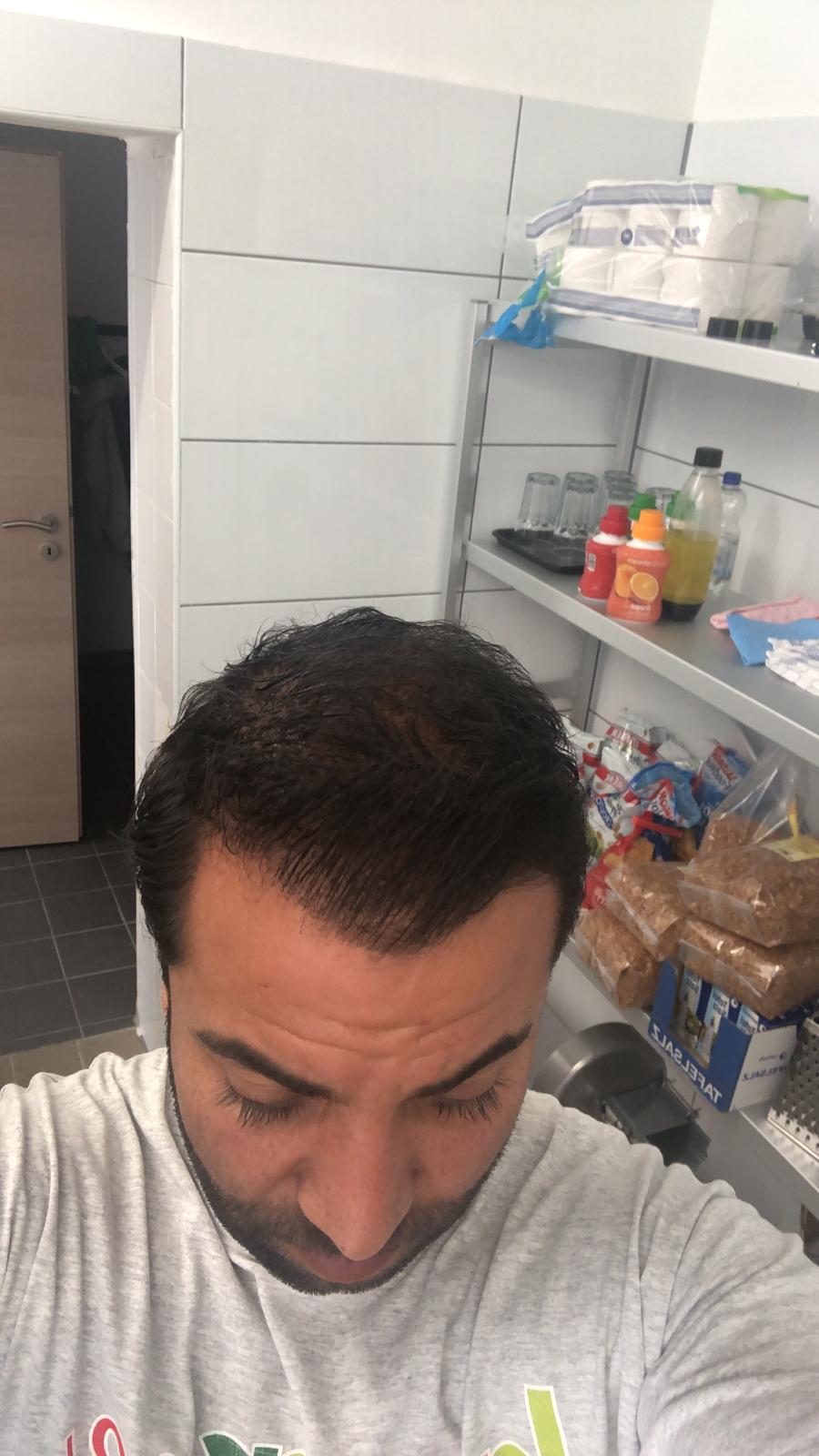 /foren/transplant/index.php/fa/43528/0/