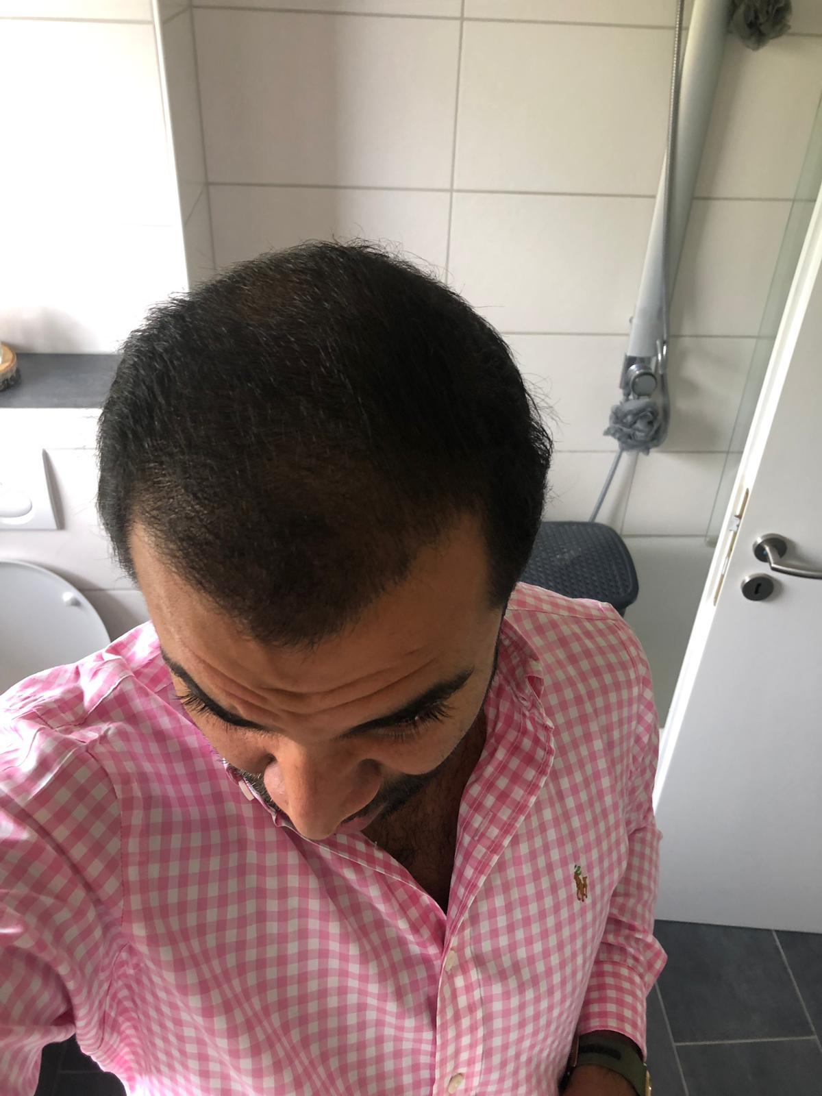 /foren/transplant/index.php/fa/43529/0/