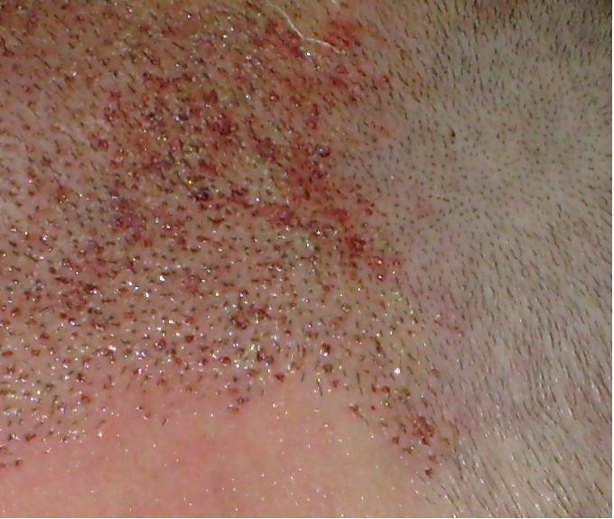 index.php/fa/4358/0/