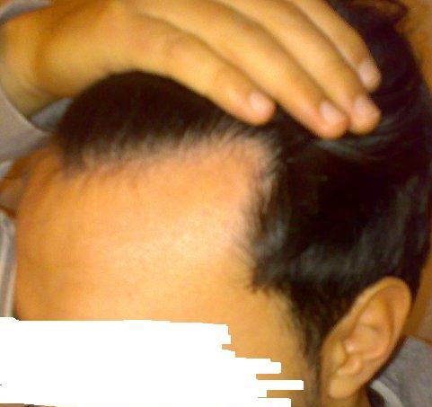 index.php/fa/4393/0/