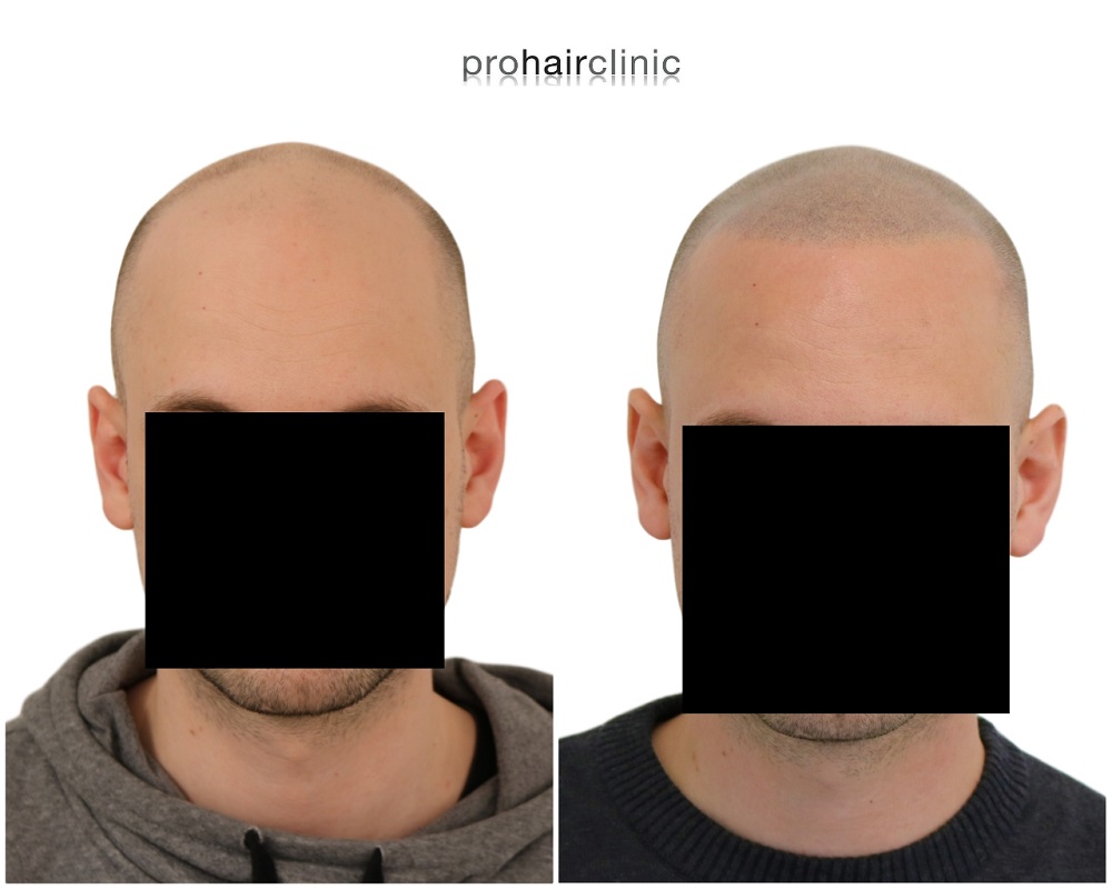 /foren/transplant/index.php/fa/43963/0/